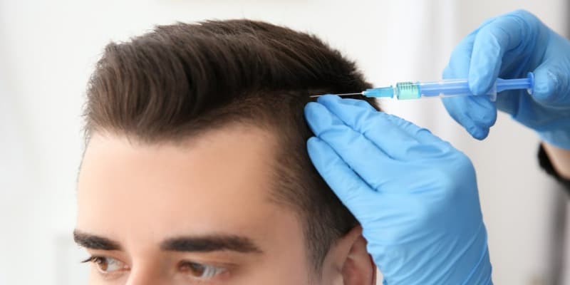 Hair Transplant Turkey: Everything You Need to Know in 2025