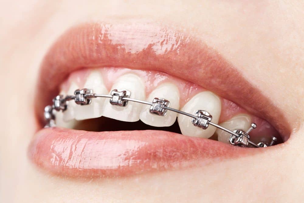 Find the Best Dentist Near Me for Comprehensive Dental Care