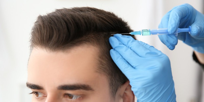 Hair Transplant Turkey: Everything You Need to Know in 2025